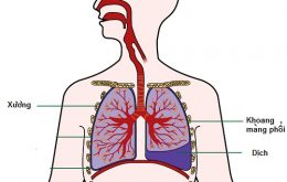 tràn dịch màng phổi - một hoạt động tăng tiết
