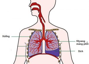 tràn dịch màng phổi - một hoạt động tăng tiết